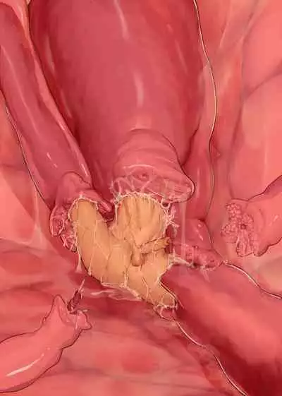 Shokushu Teien | Tentacle Garden